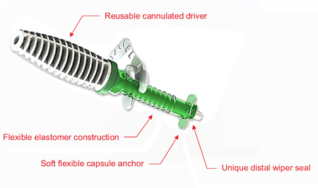 SportPort's DistalDrive System